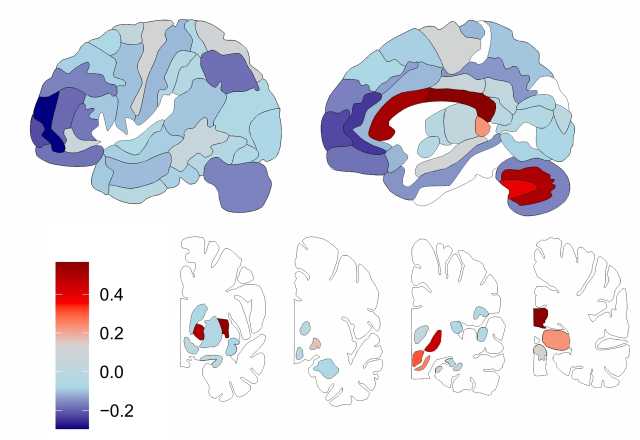 «Понять природу психических расстройств»: российские учёные создали подробную «карту жирности» мозга